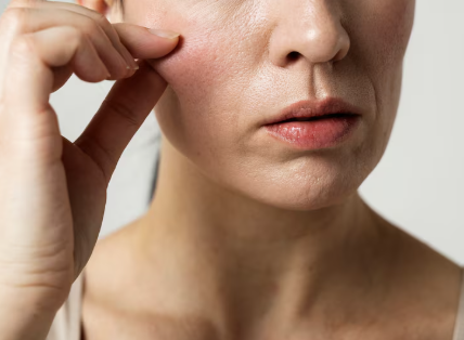 Nonhyeon Station Plastic Surgery: Thread Lift vs. Laser Lift – What's the Difference and Who Are They For? 사진 4