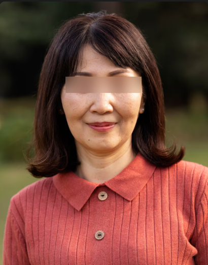 강남역성형외과 이마거상 고민된다면? 비용과 흉터에 대한 현실적인 이야기 사진 3
