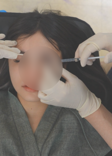 강남풀페이스필러, 부분필러와 뭐가 다를까? 가격·장단점·효과 원장이 정리해드립니다 사진 10