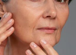 Kapan Deep Cheek Thread Lift dengan Benang Mint Gagal? Desain, Pilihan Jumlah Benang, dan Ulasan Nyata 사진 2