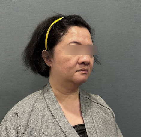 What to Look for When Choosing a Seoul Facelift Hospital: Reviews, Price, and Efficacy Standards 사진 4