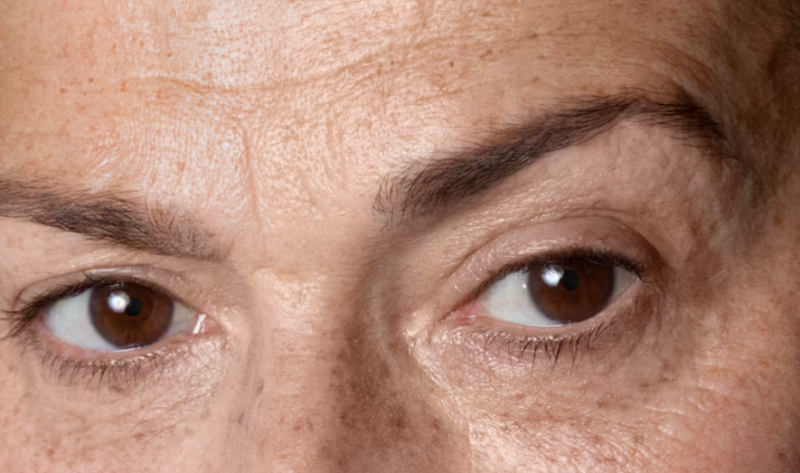 서울이마거상 두통과 감각 이상 가능성 그리고 흉터 최소화 수술 전 체크할 부분