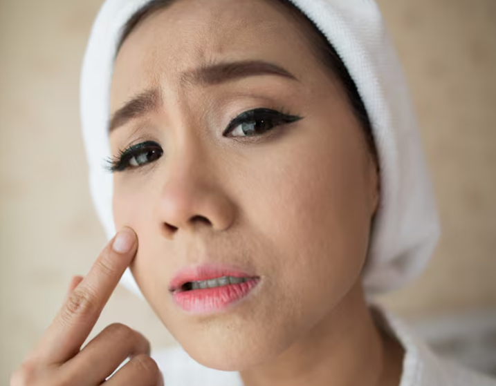 30대 이마거상 아직 이른 걸까? 수술 시기와 전후 차이 원장이 직접 정리 사진 3