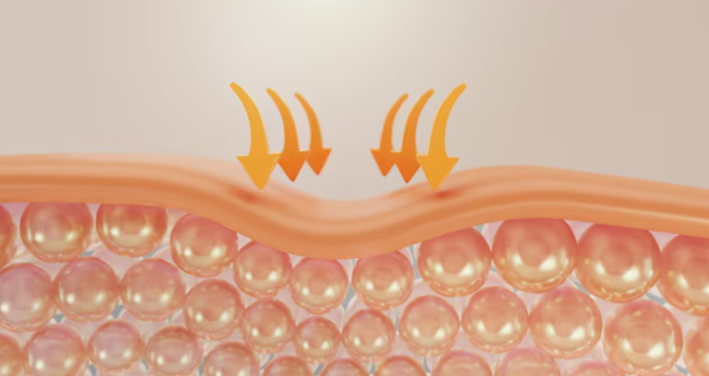Under-eye Fat Repositioning vs. Lower Blepharoplasty: What's the Difference? Criteria for Sagging & Dark Circles, and Ho