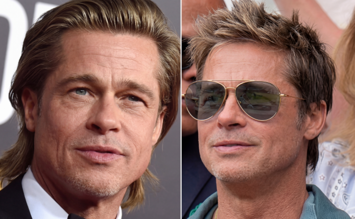 Perasaan Facelift Brad Pitt, Sejauh Mana Perubahan yang Dapat Dicapai Secara Realistis? 사진 3