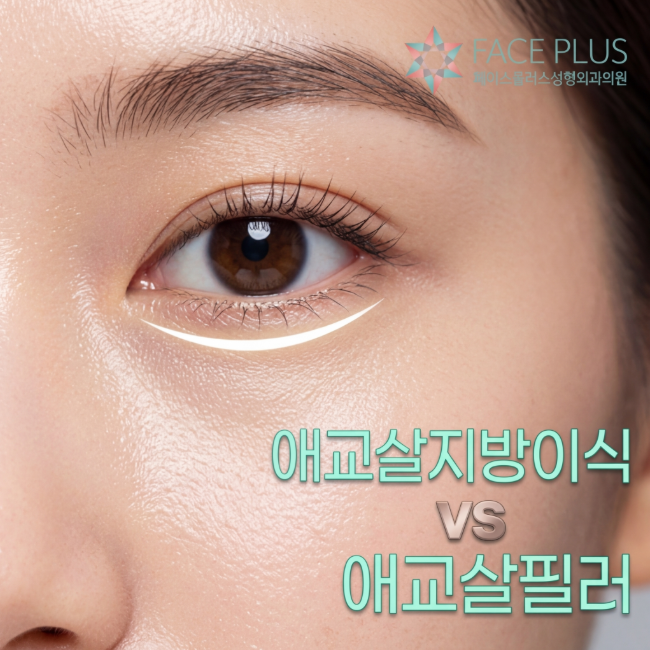Transplantasi Lemak Aegyosal vs Filler Aegyosal, Mana yang Lebih Alami? Ringkasan Durasi dan Efek Samping 사진 3