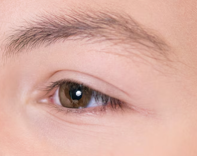 Why Drooping Eyebrow Thread Lifts Must Consider the Forehead and Eyelid Sagging Together 사진 3