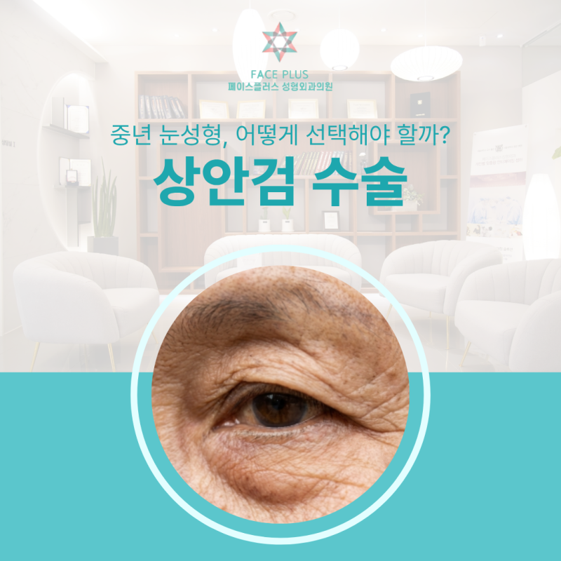 Can Middle-Aged Droopy Eyelid Surgery Be Solved with Upper Blepharoplasty Alone? The Key Lies Elsewhere 사진 7