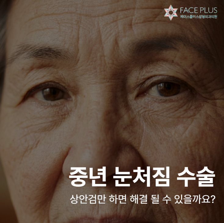 Can Middle-Aged Droopy Eyelid Surgery Be Solved with Upper Blepharoplasty Alone? The Key Lies Elsewhere