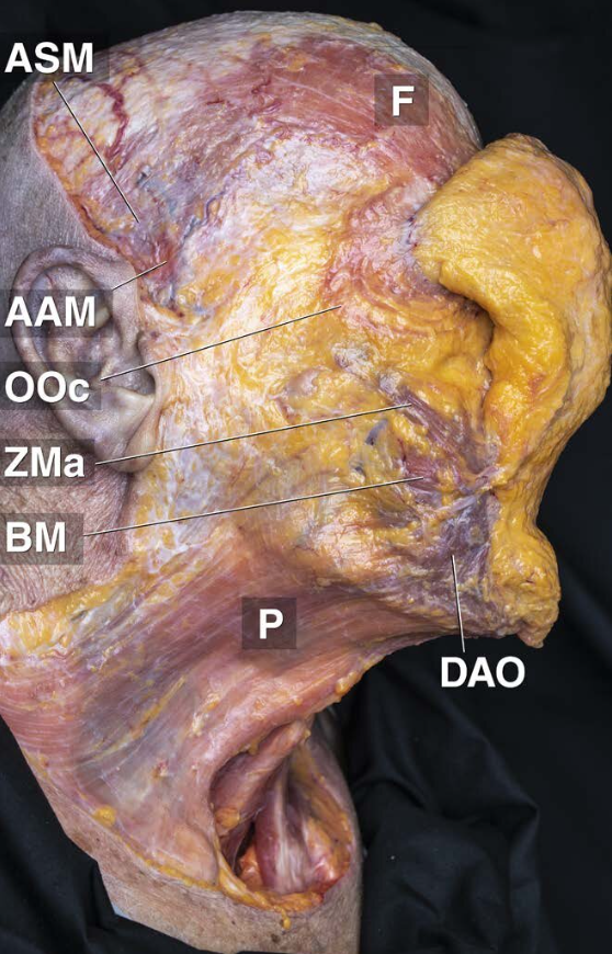 Facelift Surgery: What You Need to Know Beforehand – Price, Pain, and Recovery Period Explained 사진 4