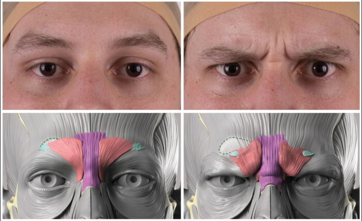 Why Karina's Forehead Lift Look Feels Different: Explaining Ptosis Improvement and Eye Shape Change 사진 5
