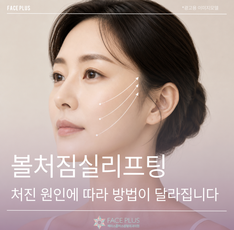 Cheek Sagging Thread Lift: Methods Vary Depending on the Cause of Sagging Cheeks