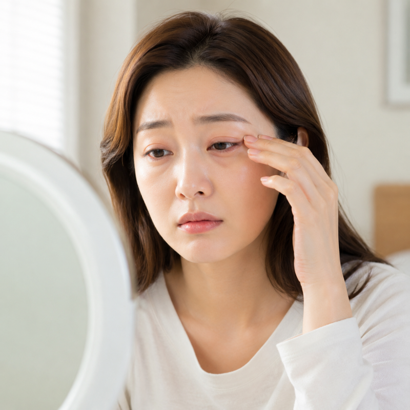 Upper and Lower Blepharoplasty Recovery Period: Swelling Timeline and Management Tips 사진 8