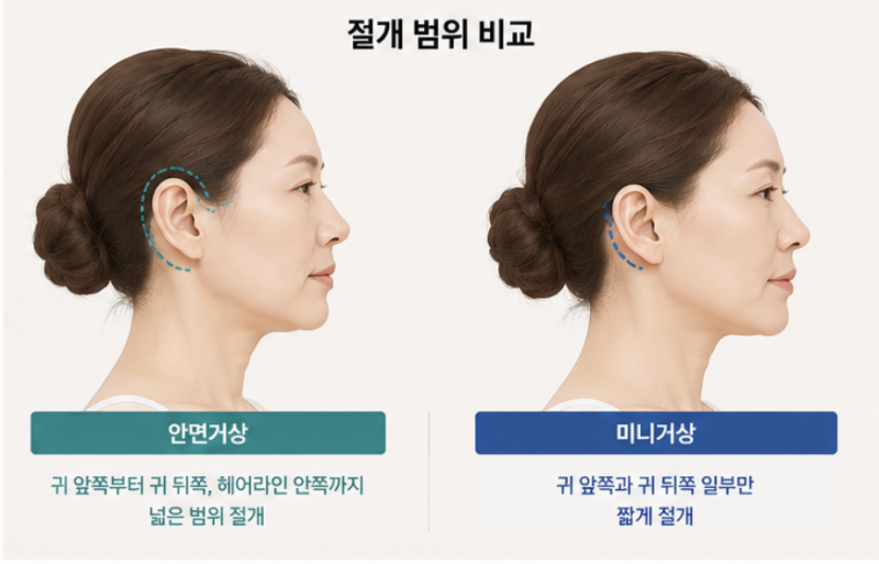 Perbedaan Face Lift dan Mini Lift, Perbedaan Krusial yang Perlu Dicek Sebelum Biaya 사진 4