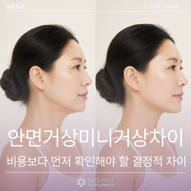 Perbedaan Face Lift dan Mini Lift, Perbedaan Krusial yang Perlu Dicek Sebelum Biaya