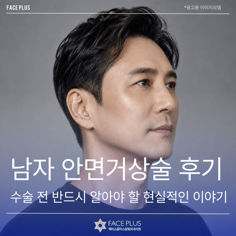 Ulasan Facelift Pria, Kisah Nyata yang Wajib Diketahui Sebelum Operasi 사진 2