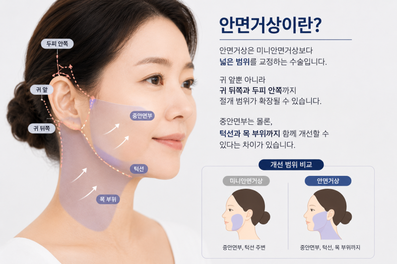 Mini Facelift vs. Full Facelift: What's the Difference? Effects, Scars, and Longevity Explained 사진 5