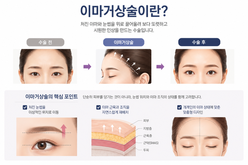 20대이마거상술, 너무 빠른 선택일까? 연령보다 중요한 기준