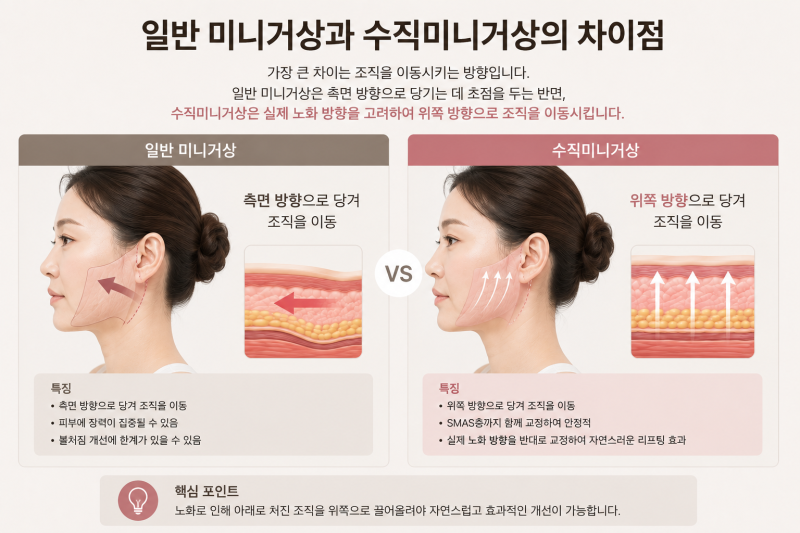 Jika Anda Khawatir dengan Pipi Kendur Setiap Kali Bercermin, Mari Bicara tentang Mini Facelift Vertikal 사진 7