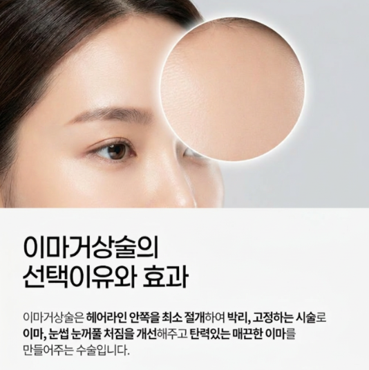이마거상술효과 분석, 얼굴 인상은 어떻게 달라질까 사진 4