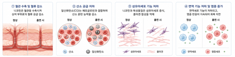 안면거상 흉터, 시간이 지나도 남는 사람과 옅어지는 사람의 차이 사진 8