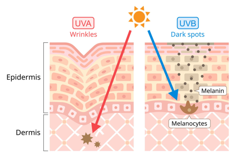 Mini Facelift Longevity: Differences Between Those Who Maintain Results Longer and Shorter 사진 6