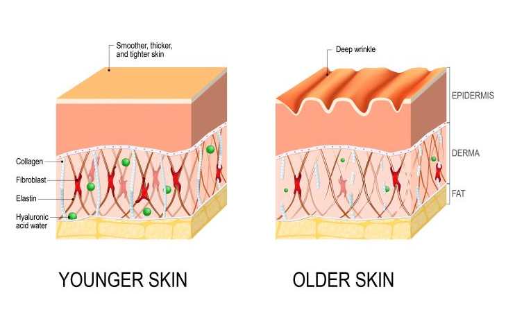 Mini Facelift Longevity: Differences Between Those Who Maintain Results Longer and Shorter 사진 5