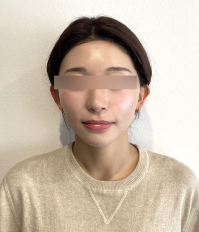 Mint Thread vs. Silhouette Soft vs. Cavaran Thread: What's the Difference in Lifting Effects? 사진 6
