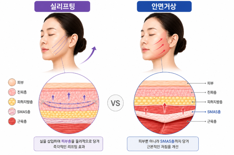 논현역성형외과, 안면거상부터 실리프팅까지 차이점 총정리 사진 5