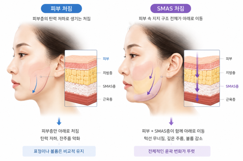 20대안면거상, 나이가 아니라 이것부터 확인해야 합니다 사진 6