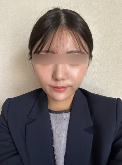 강남 실리프팅 가격, 무조건 저렴한 곳보다 중요한 기준 사진 5