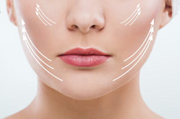 Harga Thread Lift Gangnam Station, Mengapa Berbeda di Setiap Klinik? 사진 9