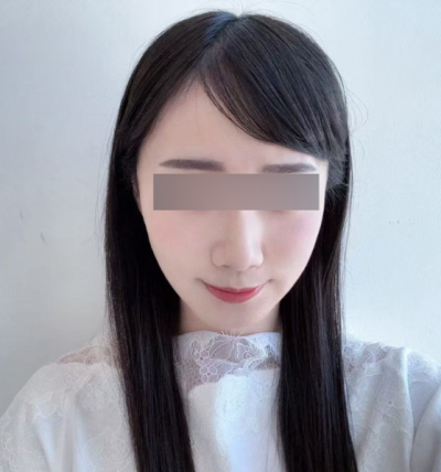 압토스실리프팅, 선택 전 헷갈리는 부분 정리 사진 6