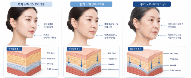 미니거상효과, 리프팅보다 만족도가 높은 경우는 언제일까요? 사진 7