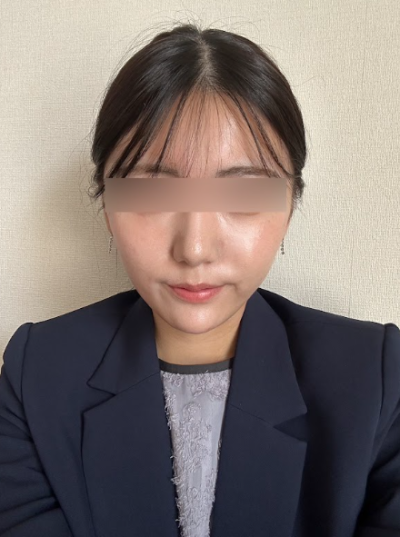 압토스, 민트실, 실루엣소프트 비교, 실리프팅 선택 기준은? 사진 10