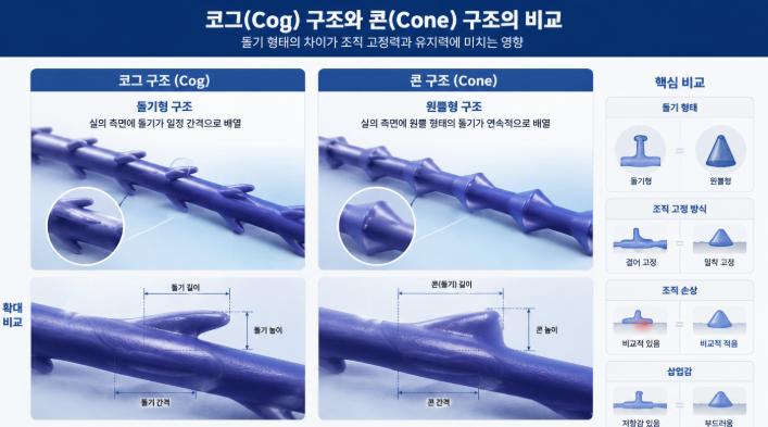 압토스, 민트실, 실루엣소프트 비교, 실리프팅 선택 기준은? 사진 5