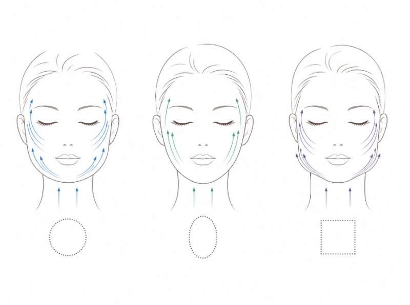 Where to Get a Good Thread Lift in Seoul: 3 Criteria for Satisfactory Results 사진 6