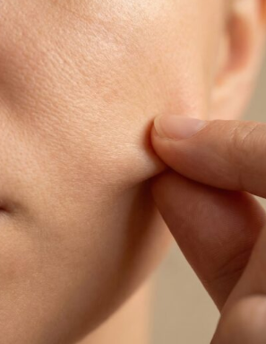 عيادة تجميل محطة سينسا، كيف تحافظ على تأثير أولثيرا برايم لفترة أطول؟ 사진 5