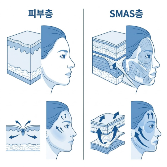 강남 안면거상 잘하는곳, 검색만으로는 알기 어려운 이야기 사진 5