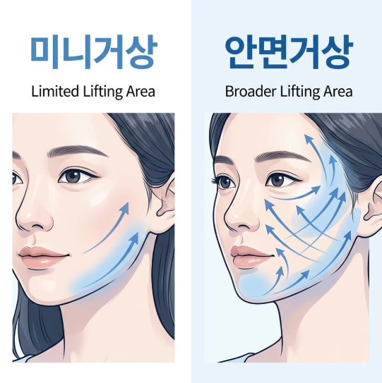 강남미니거상병원, 미니거상은 일반 안면거상과 무엇이 다를까요? 사진 5