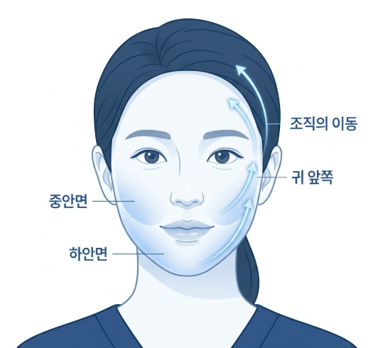강남미니거상병원, 미니거상은 일반 안면거상과 무엇이 다를까요? 사진 4