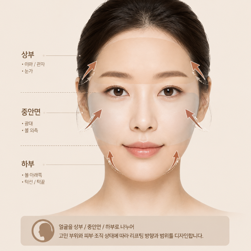 Ponytail Lift: Can it really redefine your face like a pulled-back ponytail? 사진 8