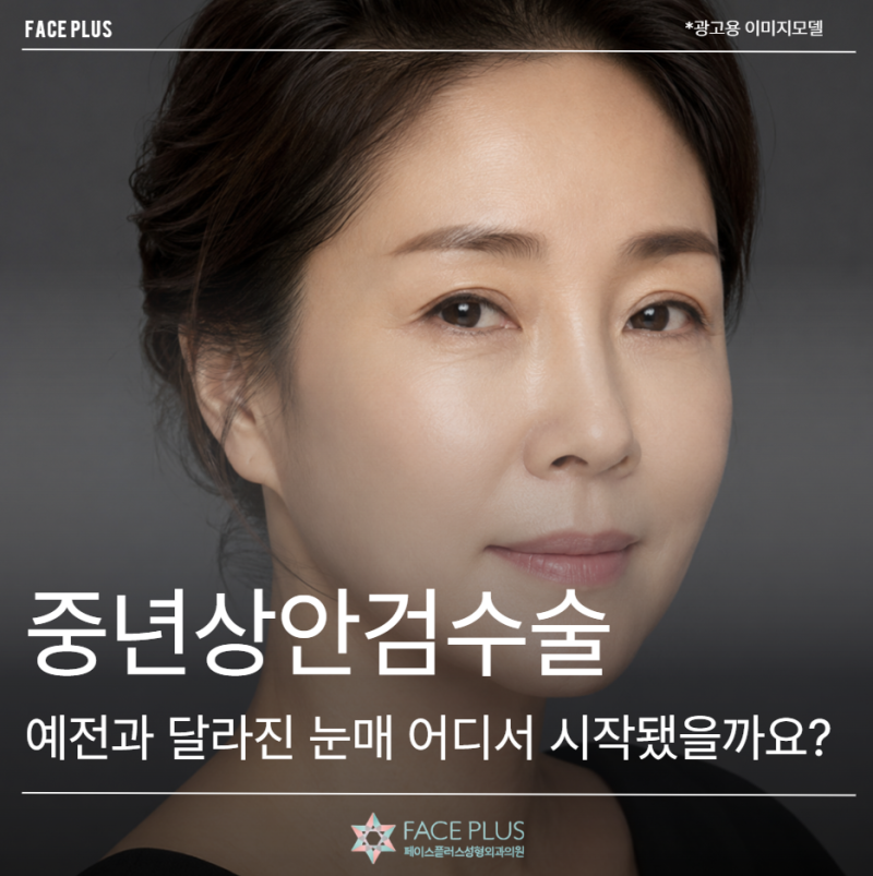 중년상안검수술, 예전과 달라진 눈매 어디서 시작됐을까요?