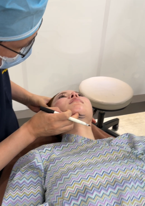 Thread Lift untuk Kerutan Garis Senyum, Seberapa Jauh Garis Senyum yang Mendalam Dapat Diperbaiki? 사진 6