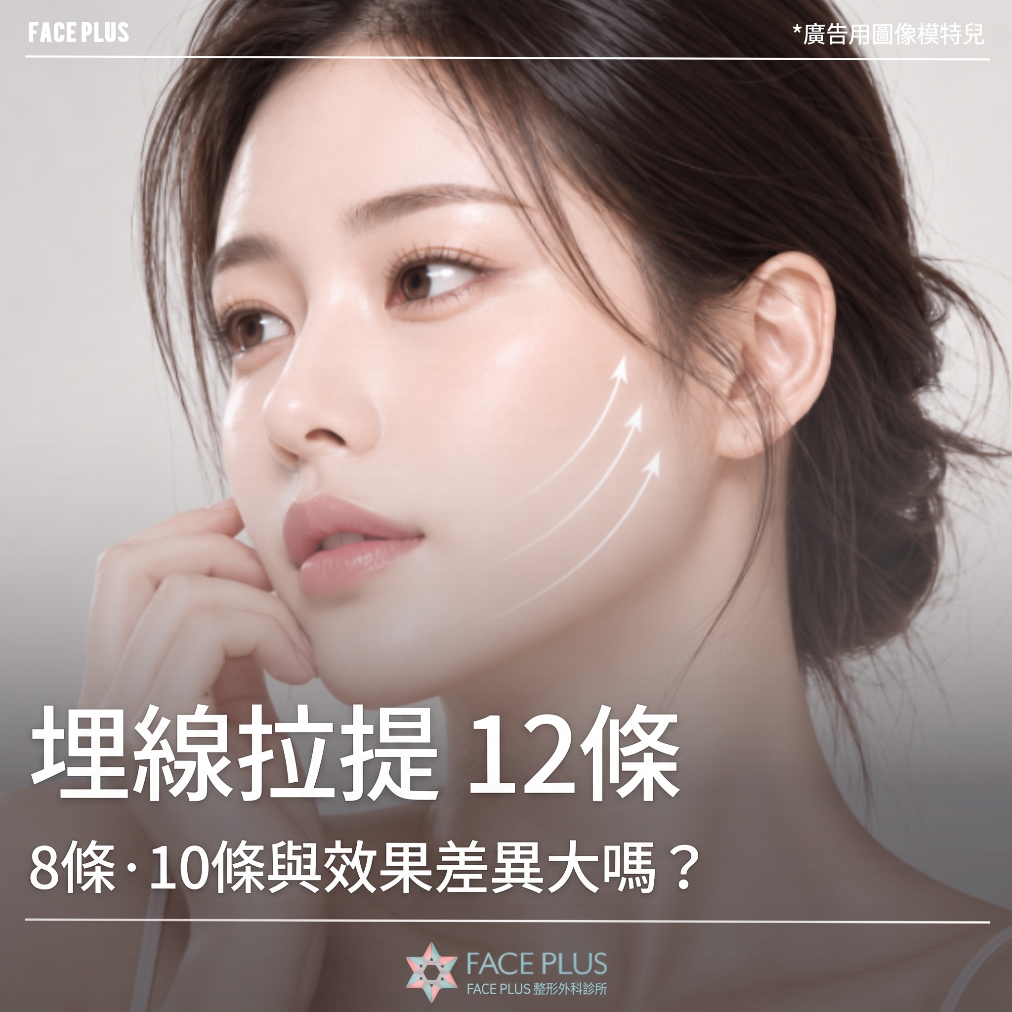 Mint線雕埋線12條，與8條、10條的效果差距大嗎？