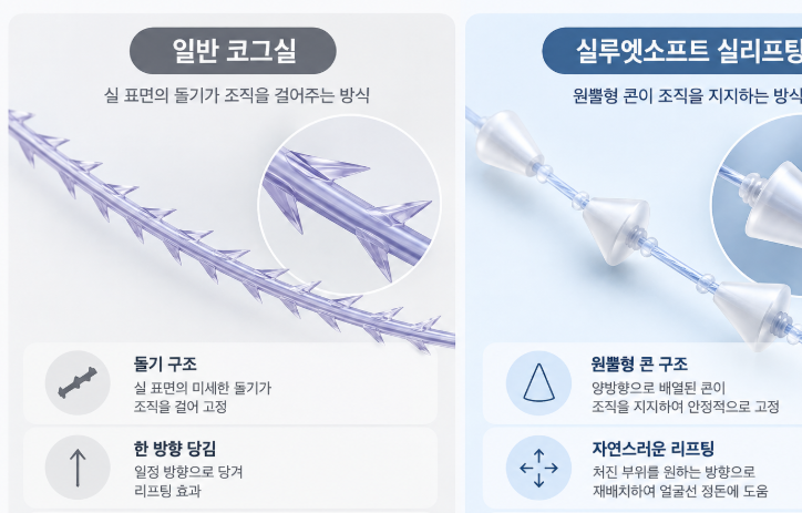실루엣소프트 실리프팅, 일반 실리프팅과 뭐가 다를까요?