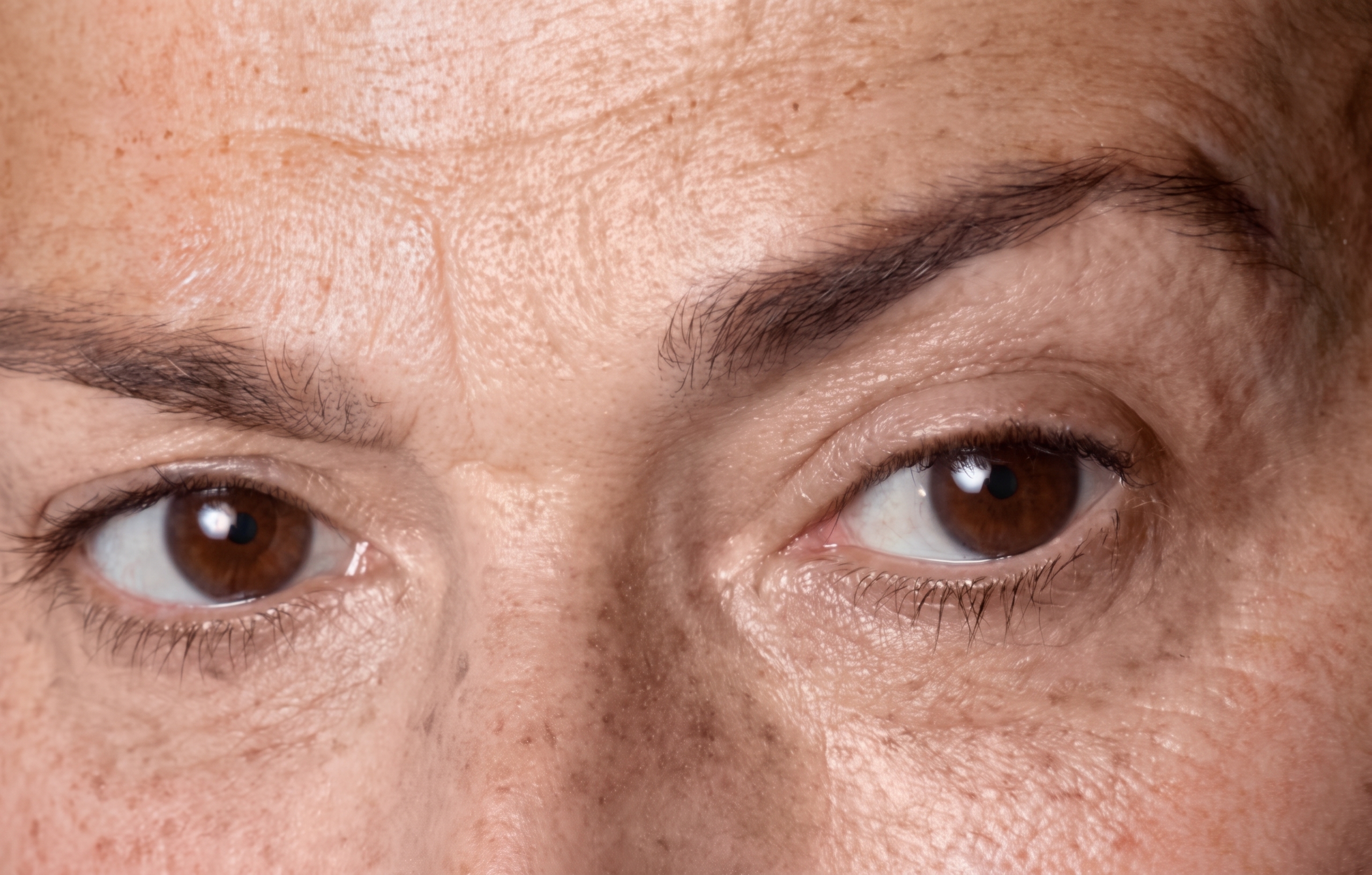 眼瞼下垂手術、まぶたが重く疲れて見えるなら原因から確認を 사진 10