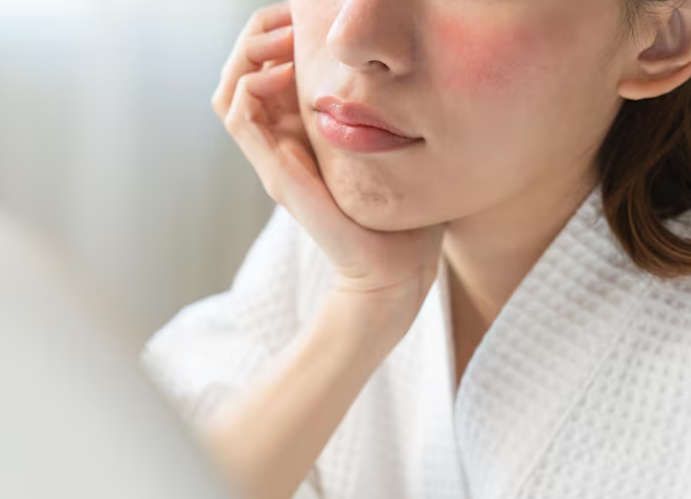 미니거상, 실리프팅과 뭐가 다를까? 처짐이 고민이라면 사진 9