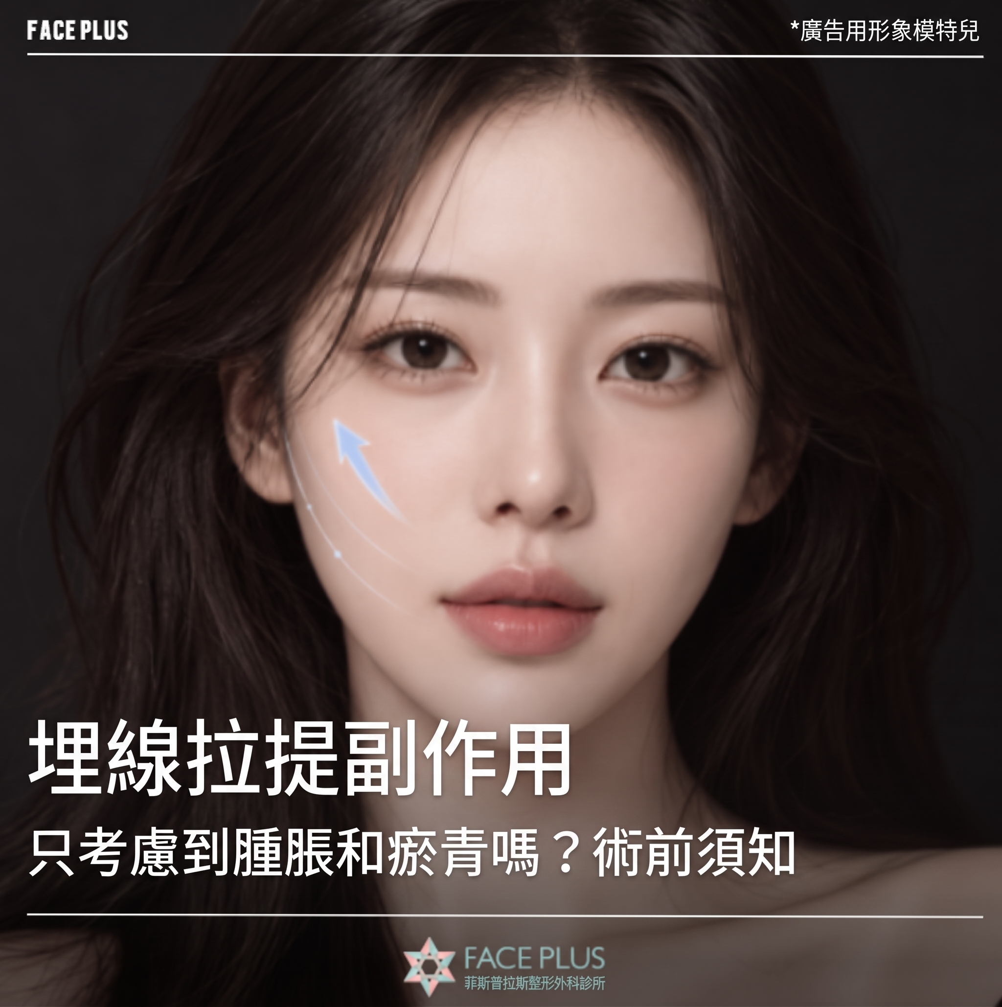 埋線拉提副作用只想到腫脹和瘀青？術前必須了解的要點