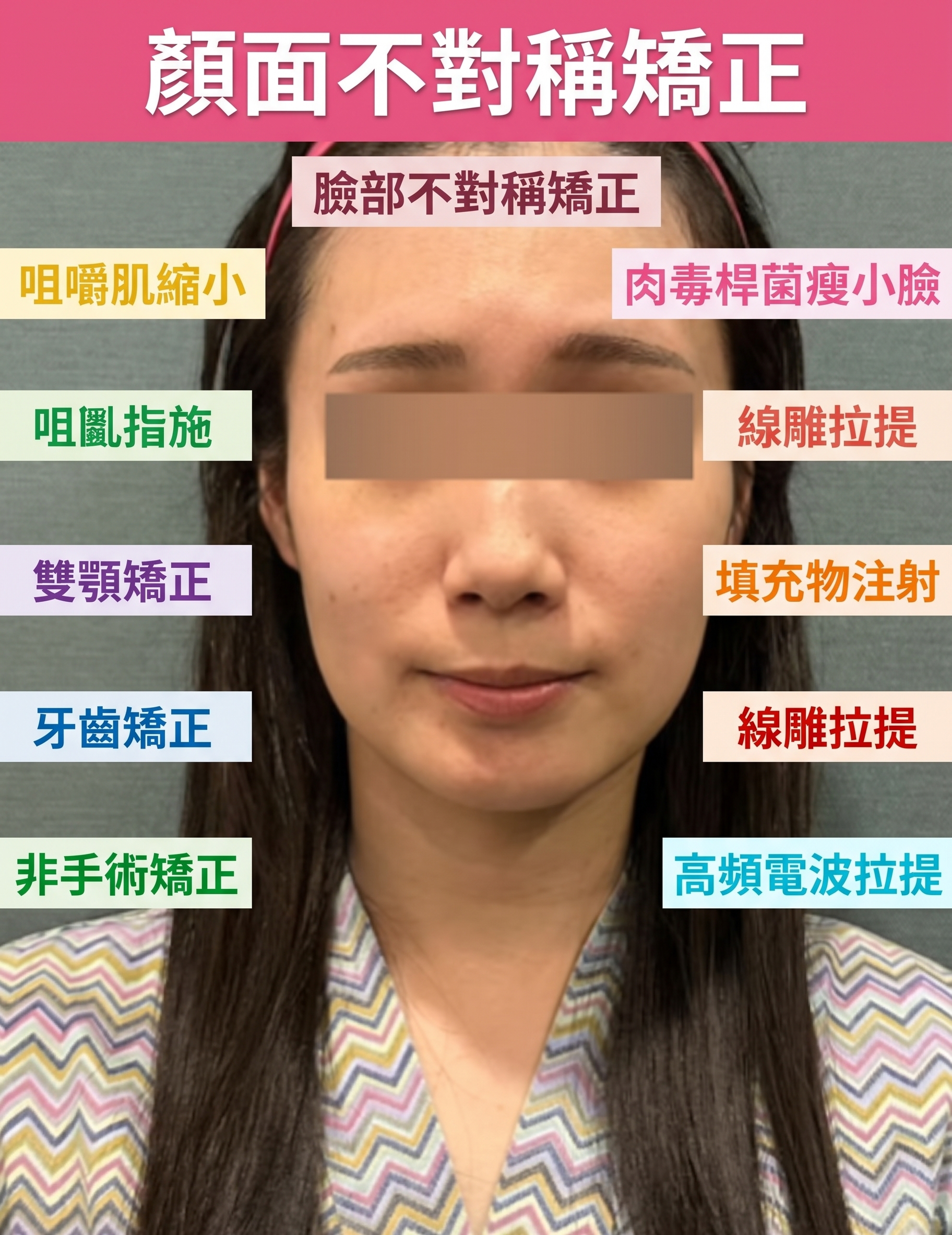 埋線拉提維持時間，做一次究竟能維持多久？ 사진 4